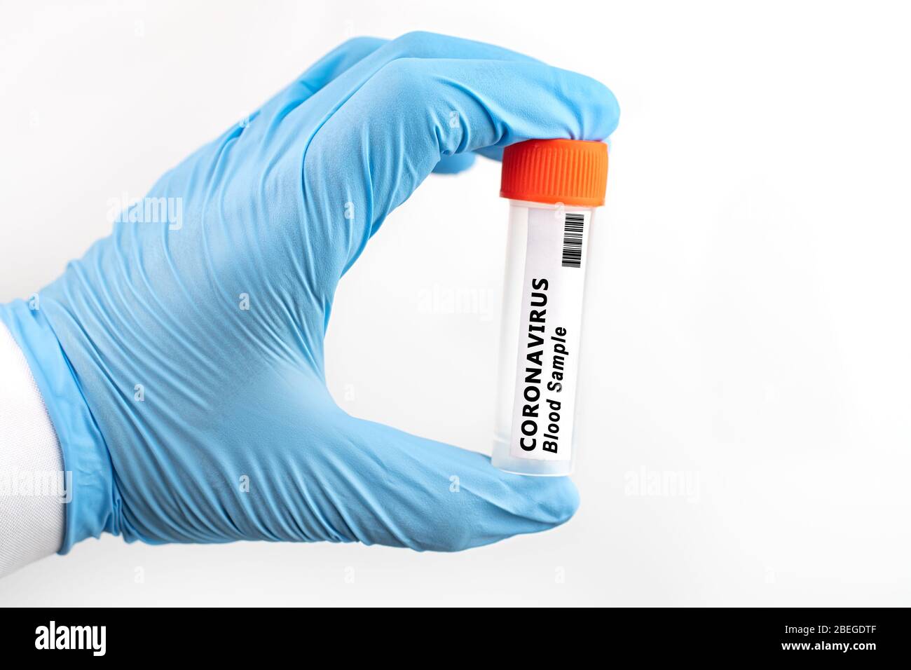Coronavirus 2019-nCoV Blutprobe. Neues Epidemisches Corona-Virus. Corona-Virus bricht aus. Corona-Virus im Labor. Wissenschaftler halten Röhrchen mit Bluttest Stockfoto