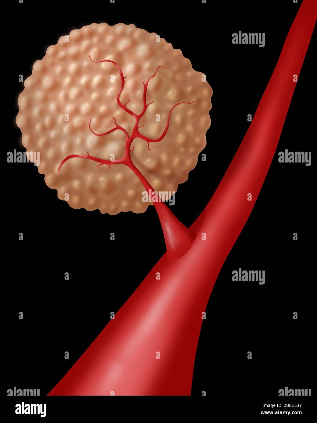 Angiogenese Stockfoto