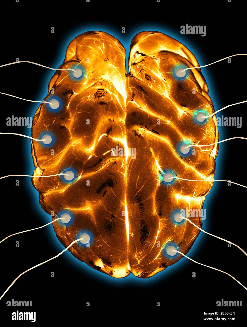 Gehirn-EEG Stockfoto