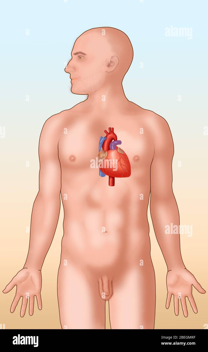 Anatomische Position des Herzens Stockfoto