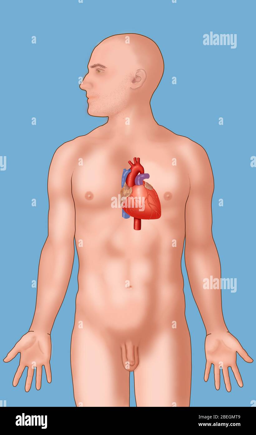 Anatomische Position des Herzens Stockfoto