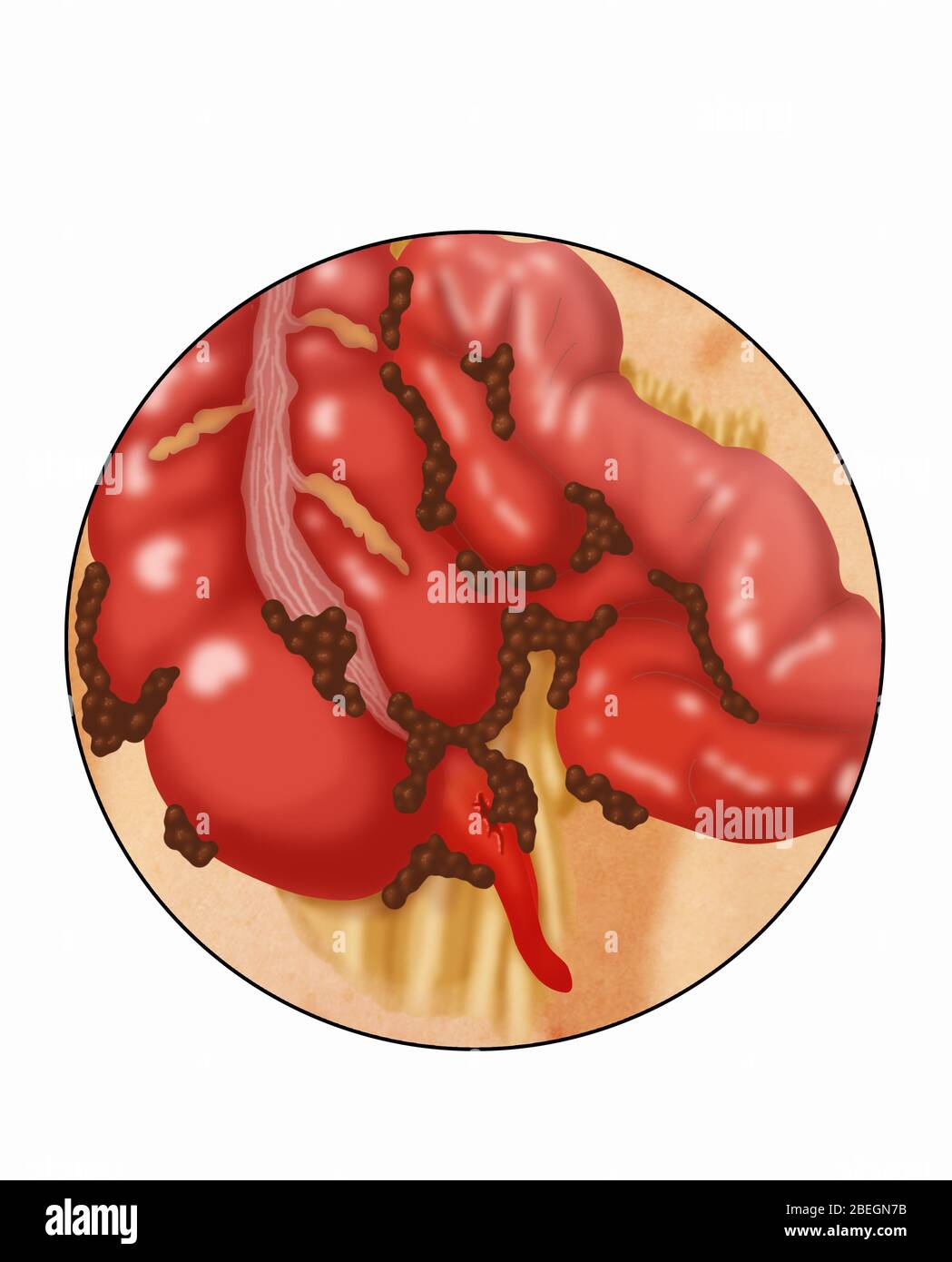 Anhang Mit Riser Stockfoto
