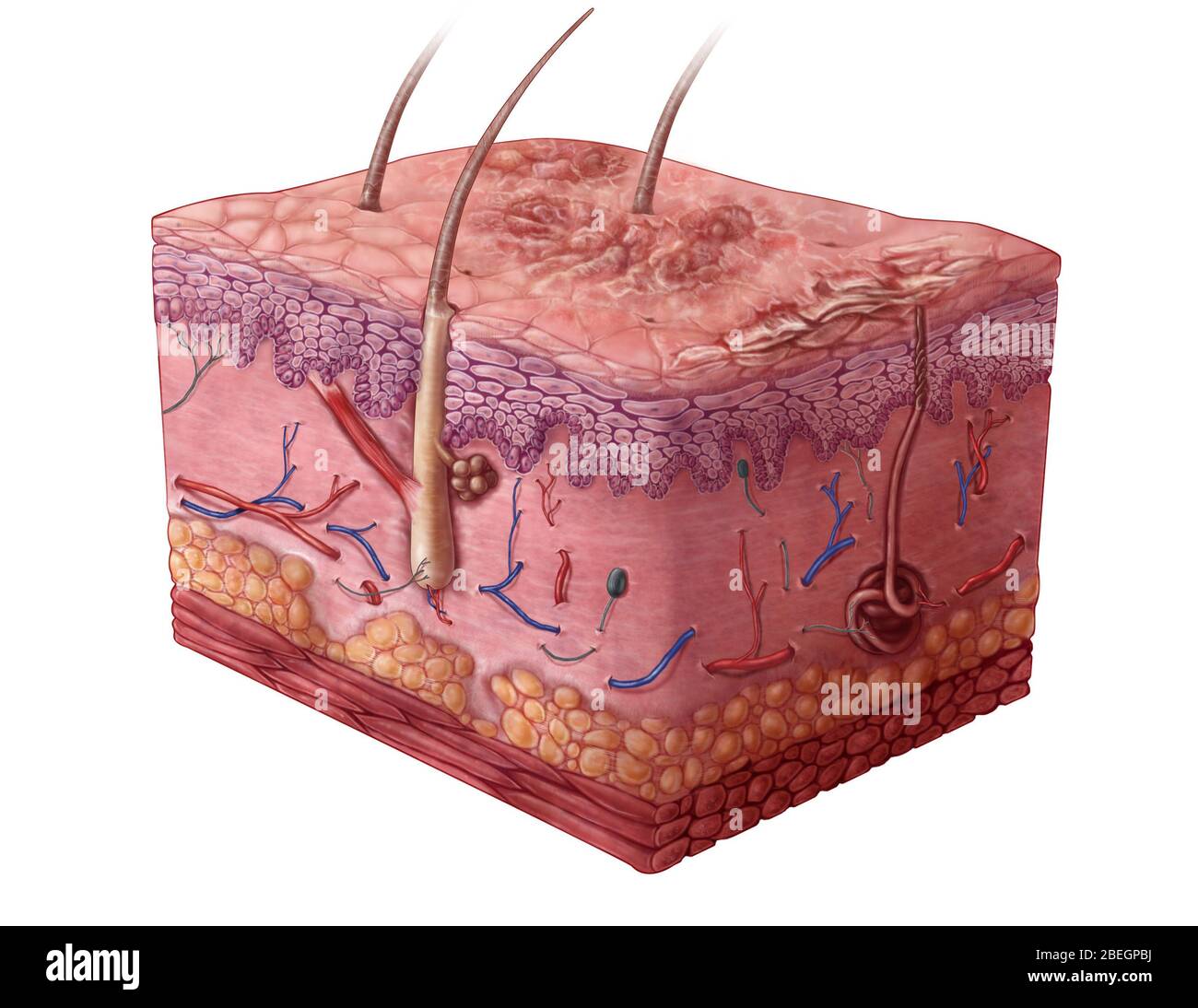 Mäßige Psoriasis Stockfoto