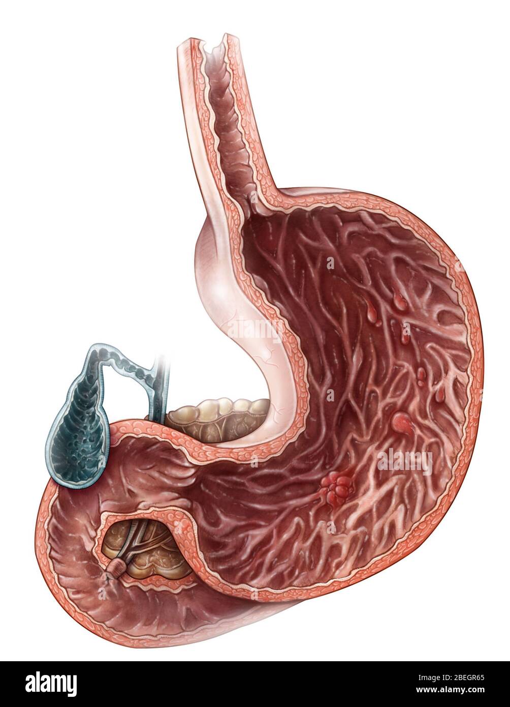 Magenpolypen Stockfoto