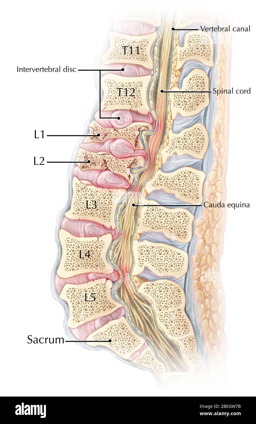 Lumbale Kompressionsfraktur Stockfoto