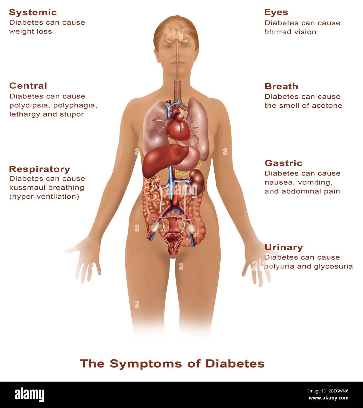 Symptome von Diabetes Stockfoto
