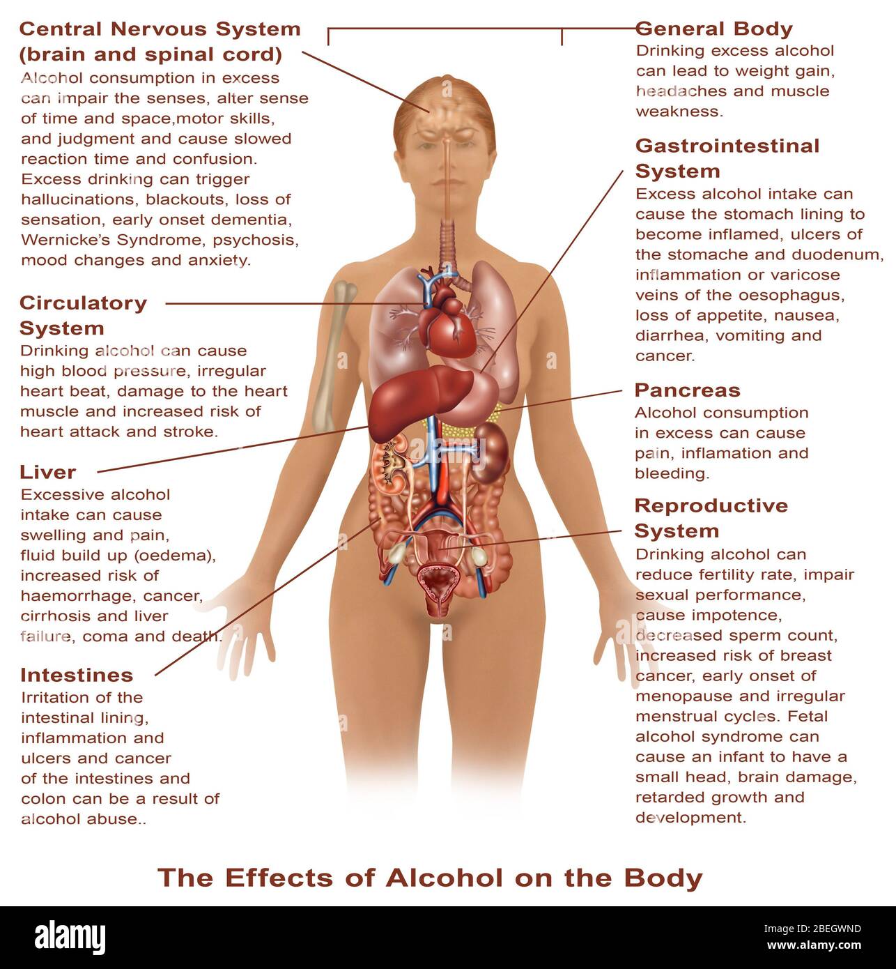 Auswirkungen des Alkoholkonsums Stockfoto