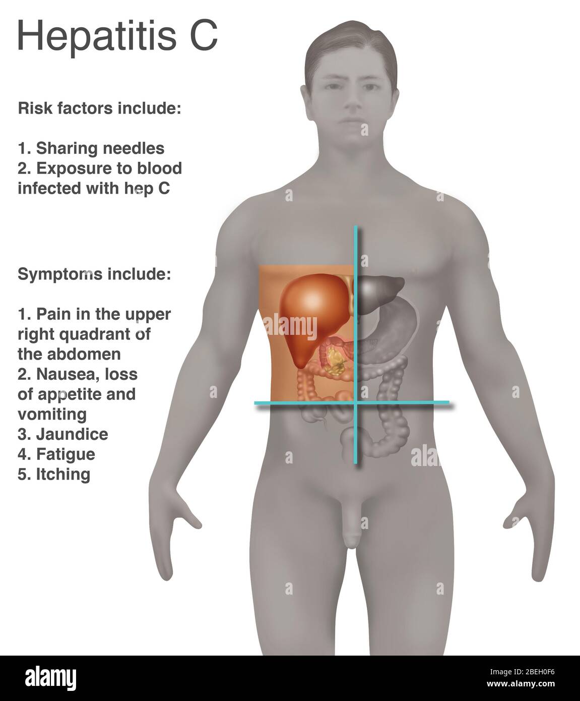 Hepatitis C Stockfoto