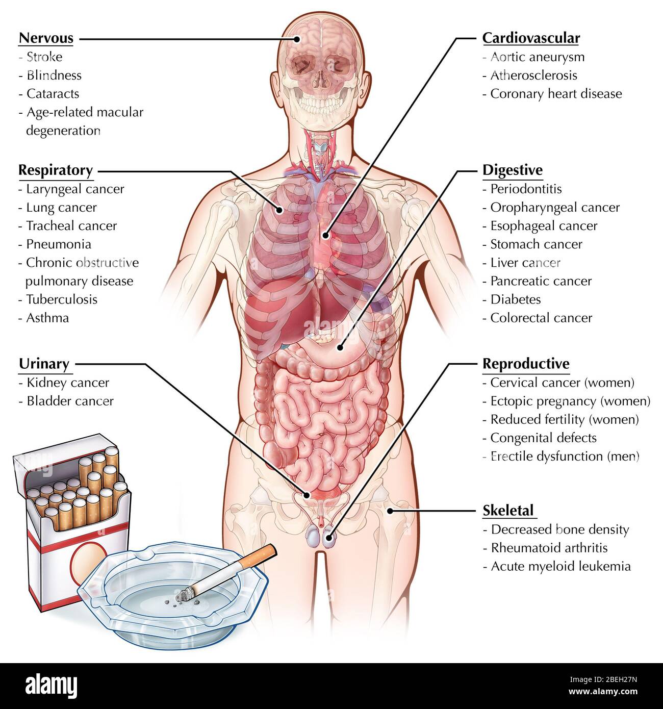 Auswirkungen des Rauchens Stockfoto