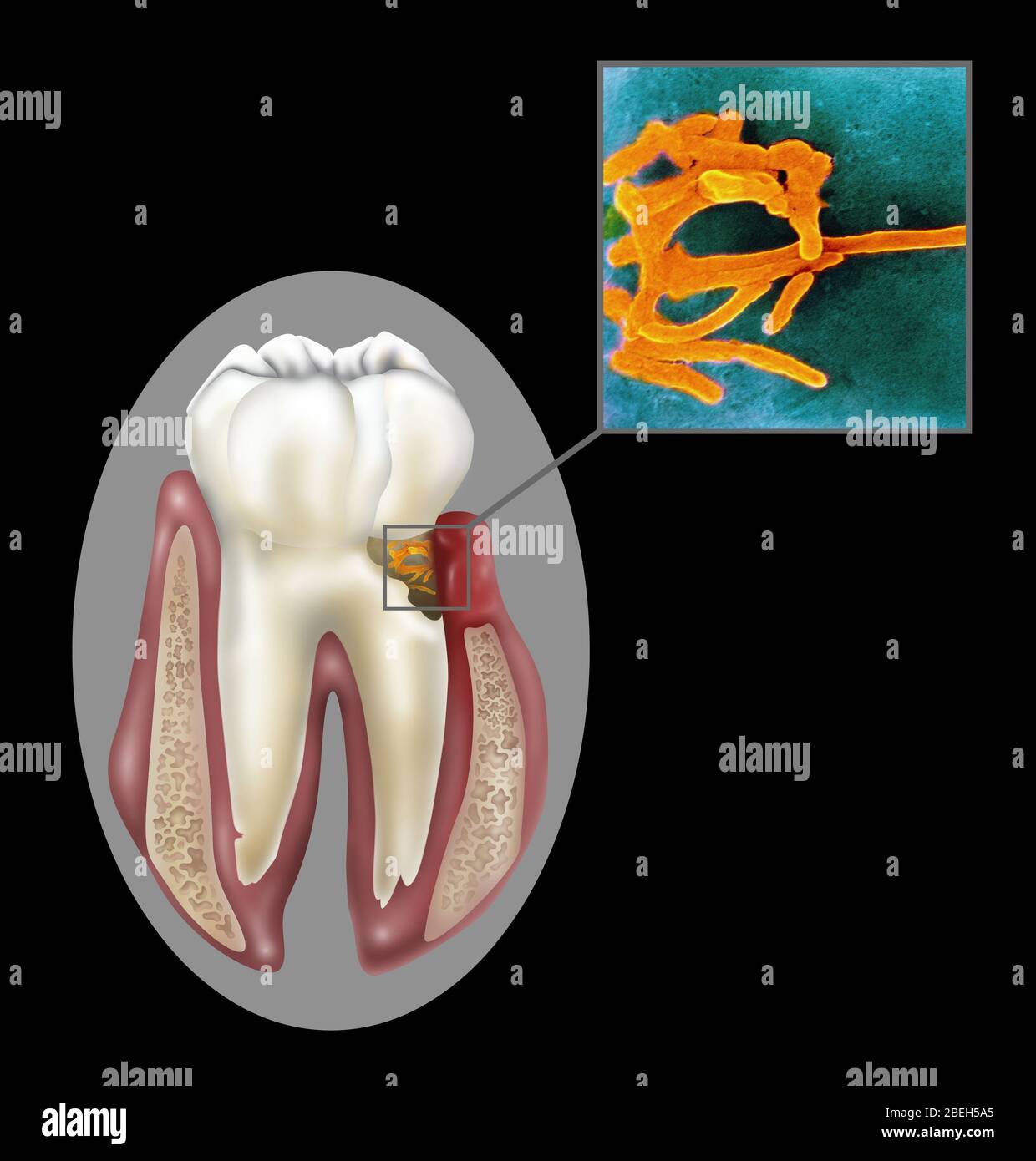 Oral bacteria -Fotos und -Bildmaterial in hoher Auflösung – Alamy