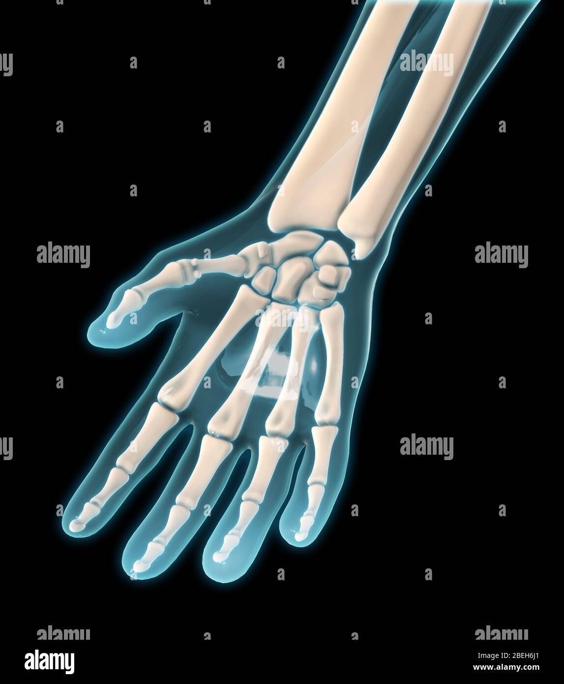 Eine palmarer Ansicht der Knochen der rechten Hand. Stockfoto