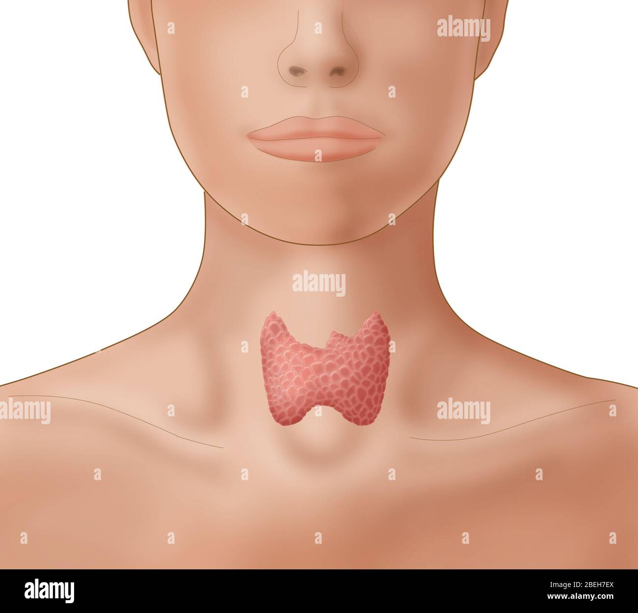 Schilddrüse im Nacken der Frau Stockfoto