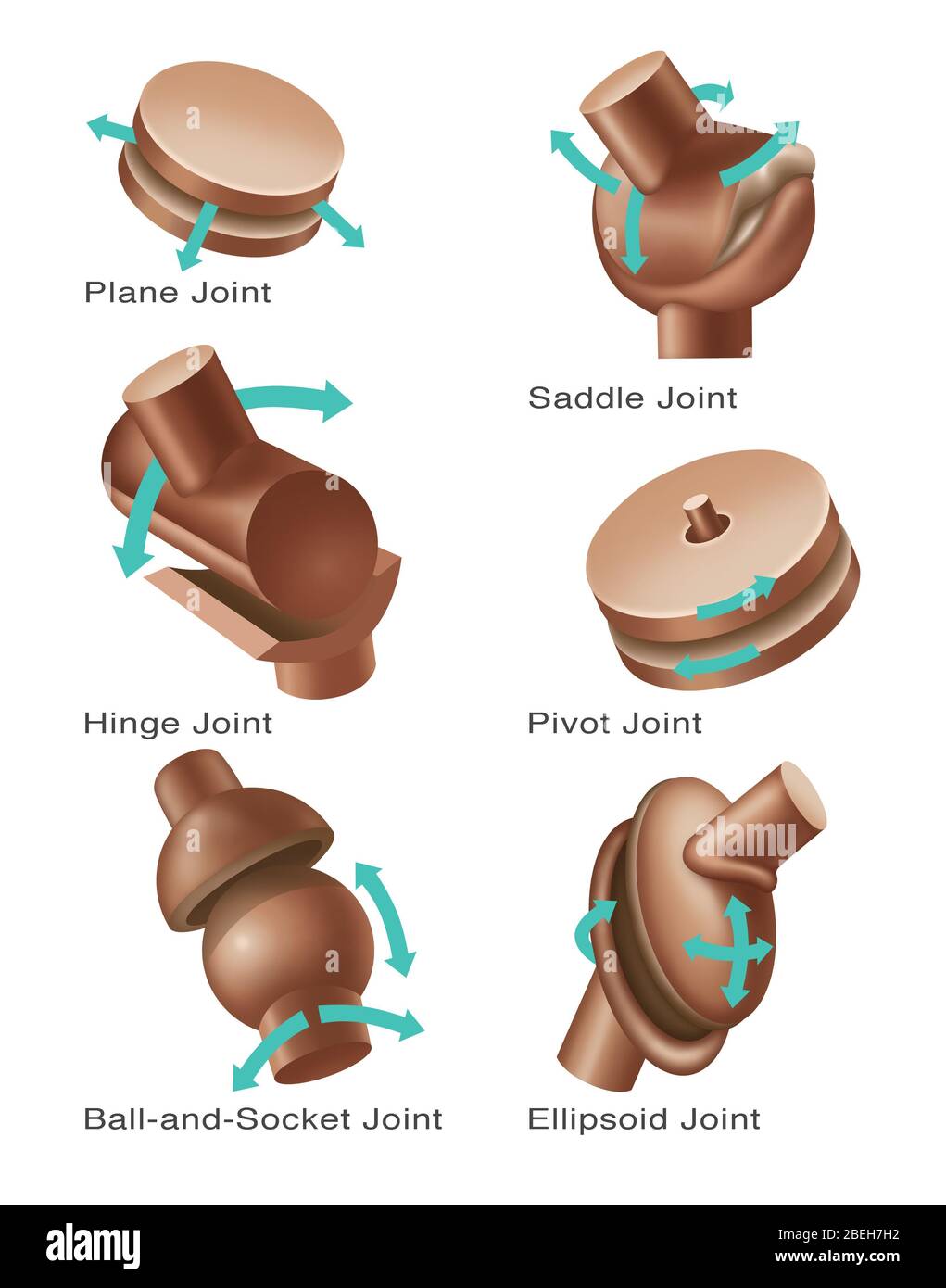 Gelenkersetzungen, Abbildung Stockfoto