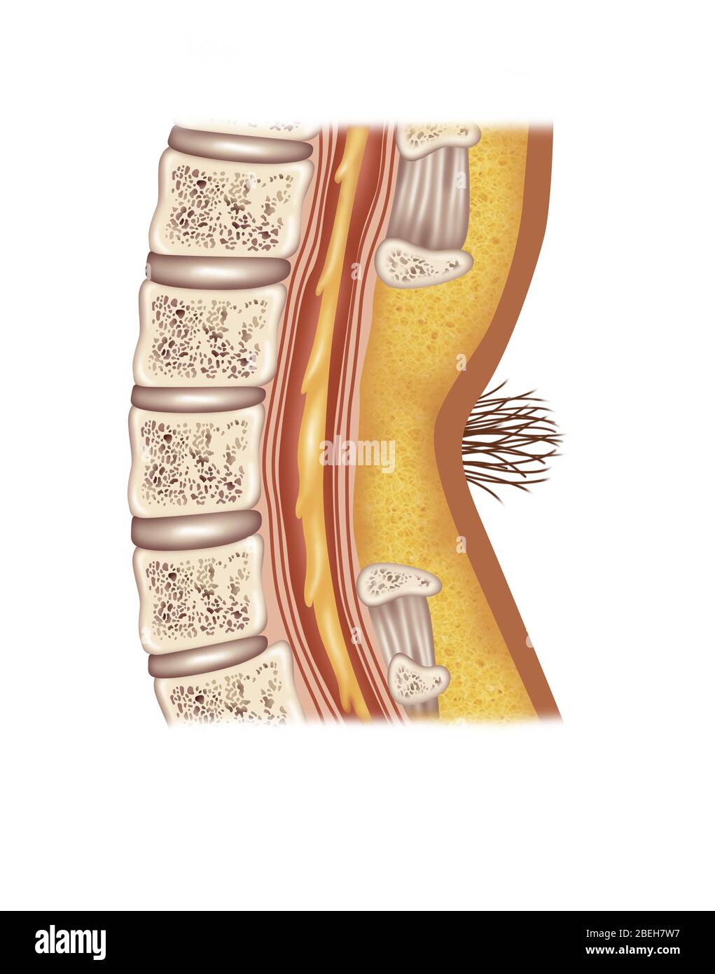 Spina Bifida Occulta, Illustration Stockfoto