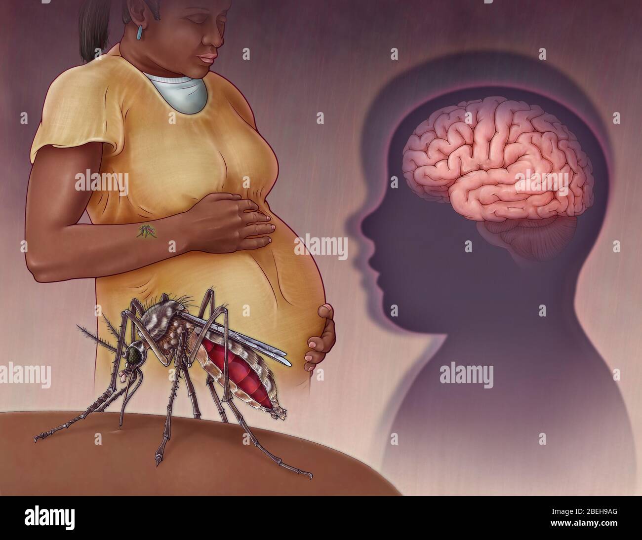 Zika Virus, Illustration Stockfoto