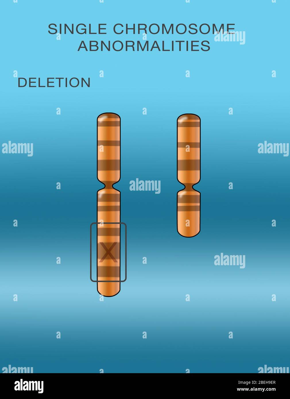 Chromosomenlöschung, Abbildung Stockfoto