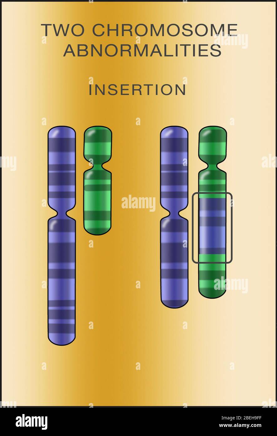 Chromosomeneinfügung, Abbildung Stockfoto
