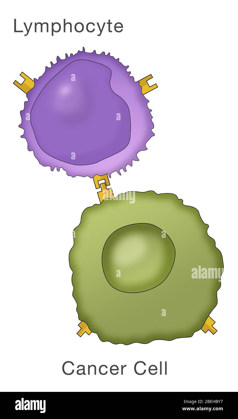 Lymphozyten und Krebszellen Stockfoto