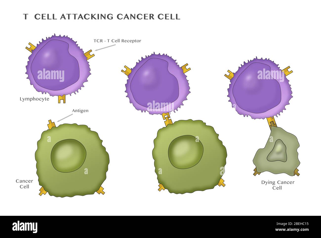 T-Zelle Angriff Krebszelle Stockfoto