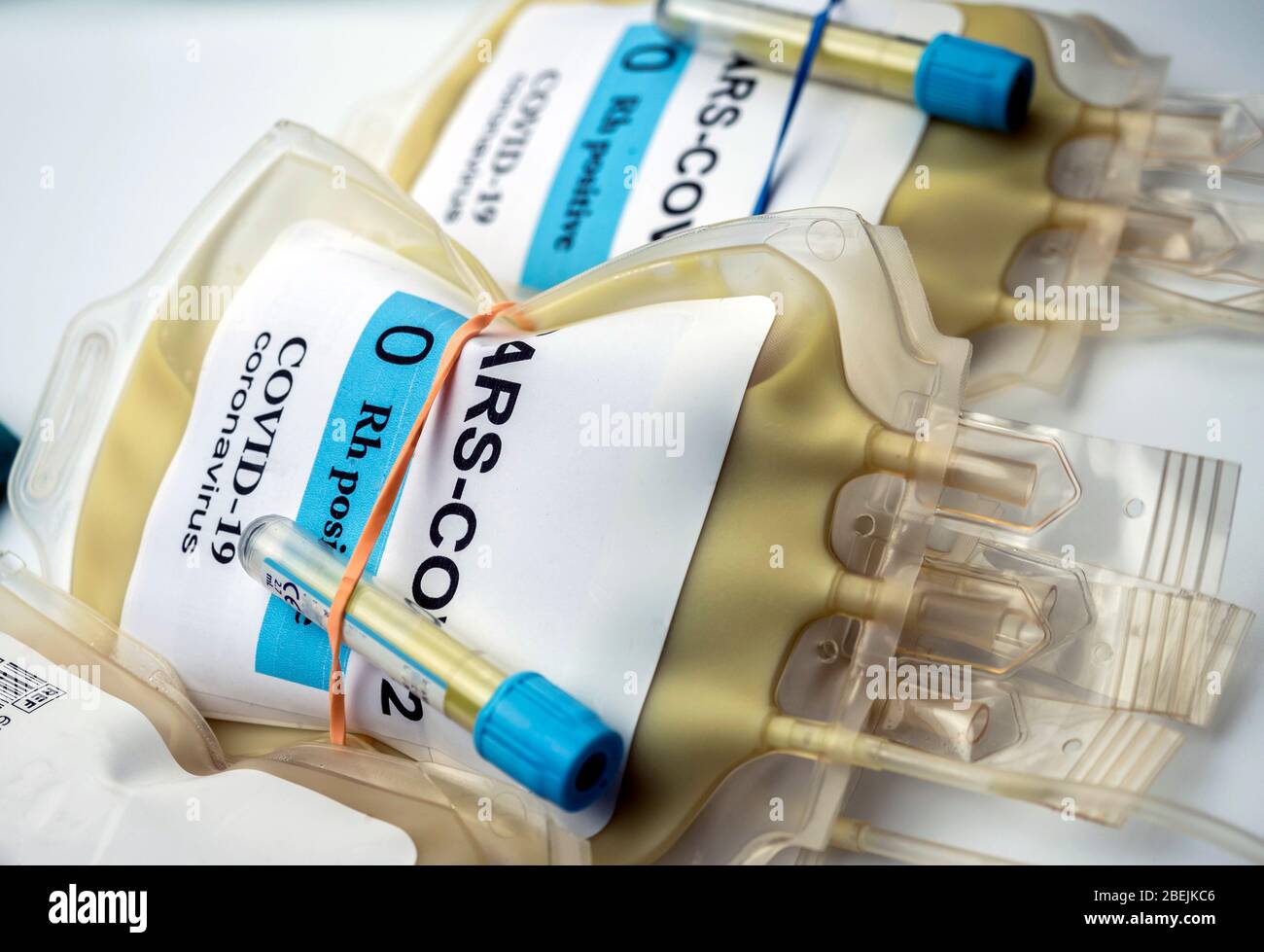 Plasmabeutel mit Antikörpern von Menschen, die von SARS-COV-2 Covid-19 geheilt wurden, vorbereitet in einem Krankenhaus, konzeptionelles Bild Stockfoto