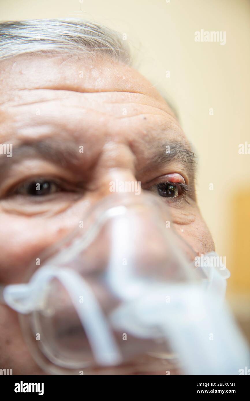 Leitender Mann, der medizinische Geräte für die Inhalation mit Atemschutzmaske verwendet, Vernebler im Zimmer Stockfoto