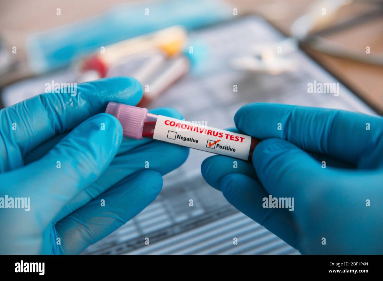 Arzt hält Pandemic Coronavirus 2019-nCoV Blutprobe positive Teströhrchen. Arzt mit medizinischer Maske und Handschuhen mit Corona-Virus (COVID-19) Stockfoto
