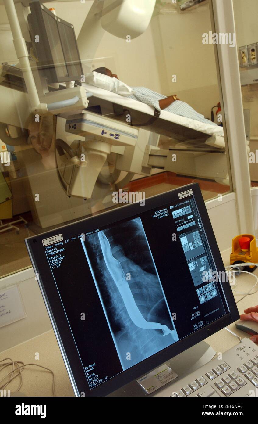 X ray of a stomach -Fotos und -Bildmaterial in hoher Auflösung – Alamy