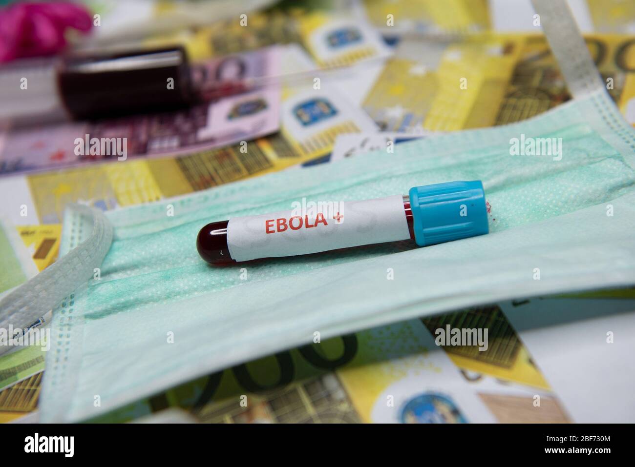 Euro Geld und Schlauch mit Blut und positiven Test bei Ebola. Stockfoto