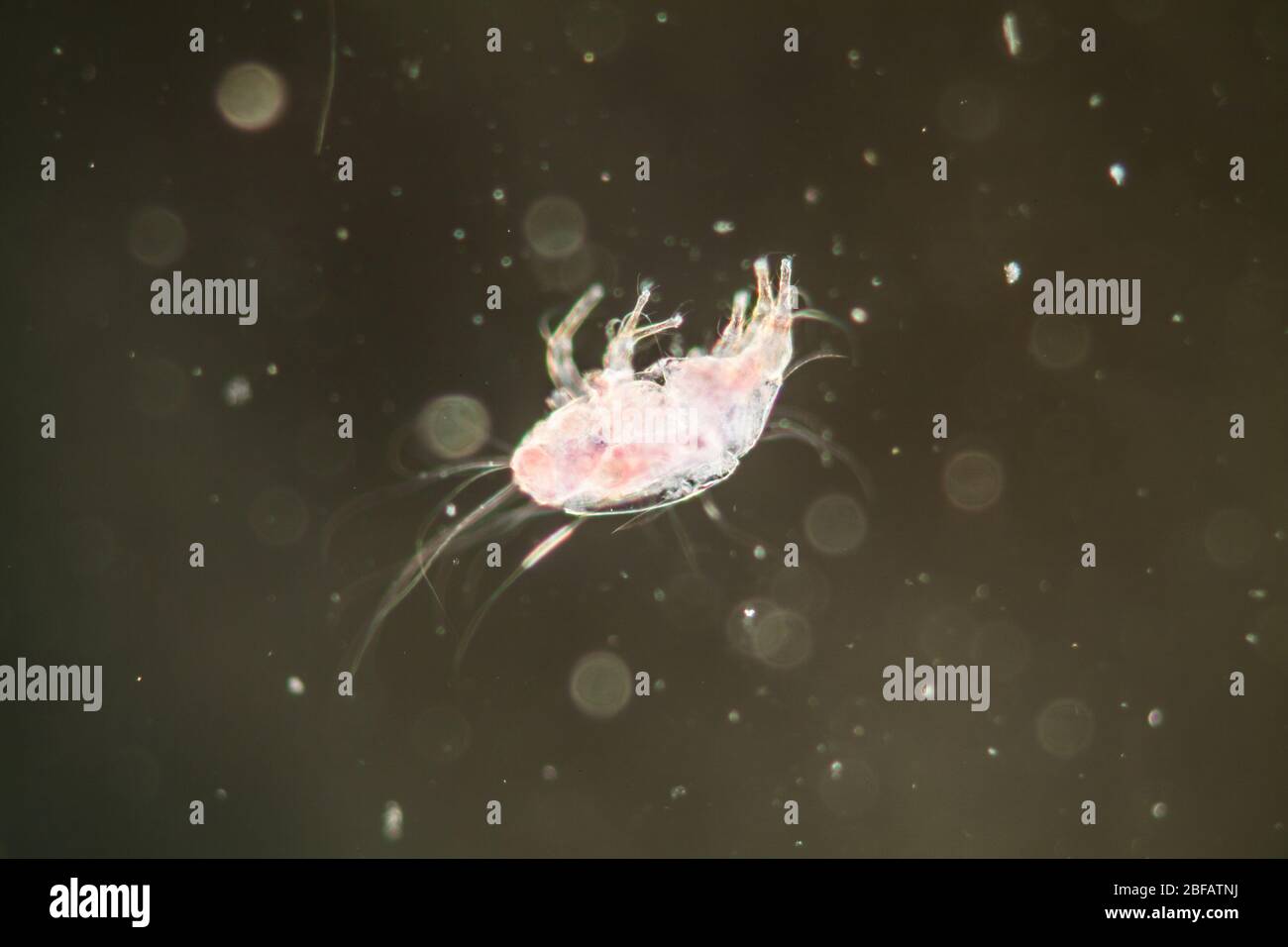 Hausstaubmilbe unter dem Mikroskop 100x Stockfotografie - Alamy