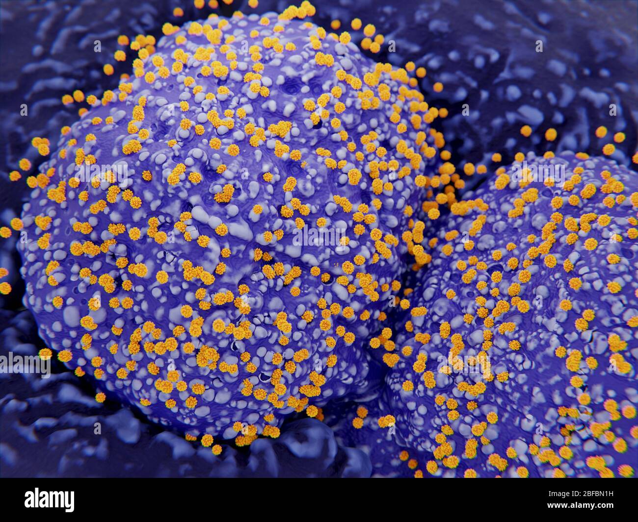Darstellung des neuen Coronavirus SARS-CoV-2, das aus infizierten Typ-II-Pneumozyten in der menschlichen Lunge austrophen kann. Die dunkleren Zellen sind Typ I Pneumozyten. Stockfoto