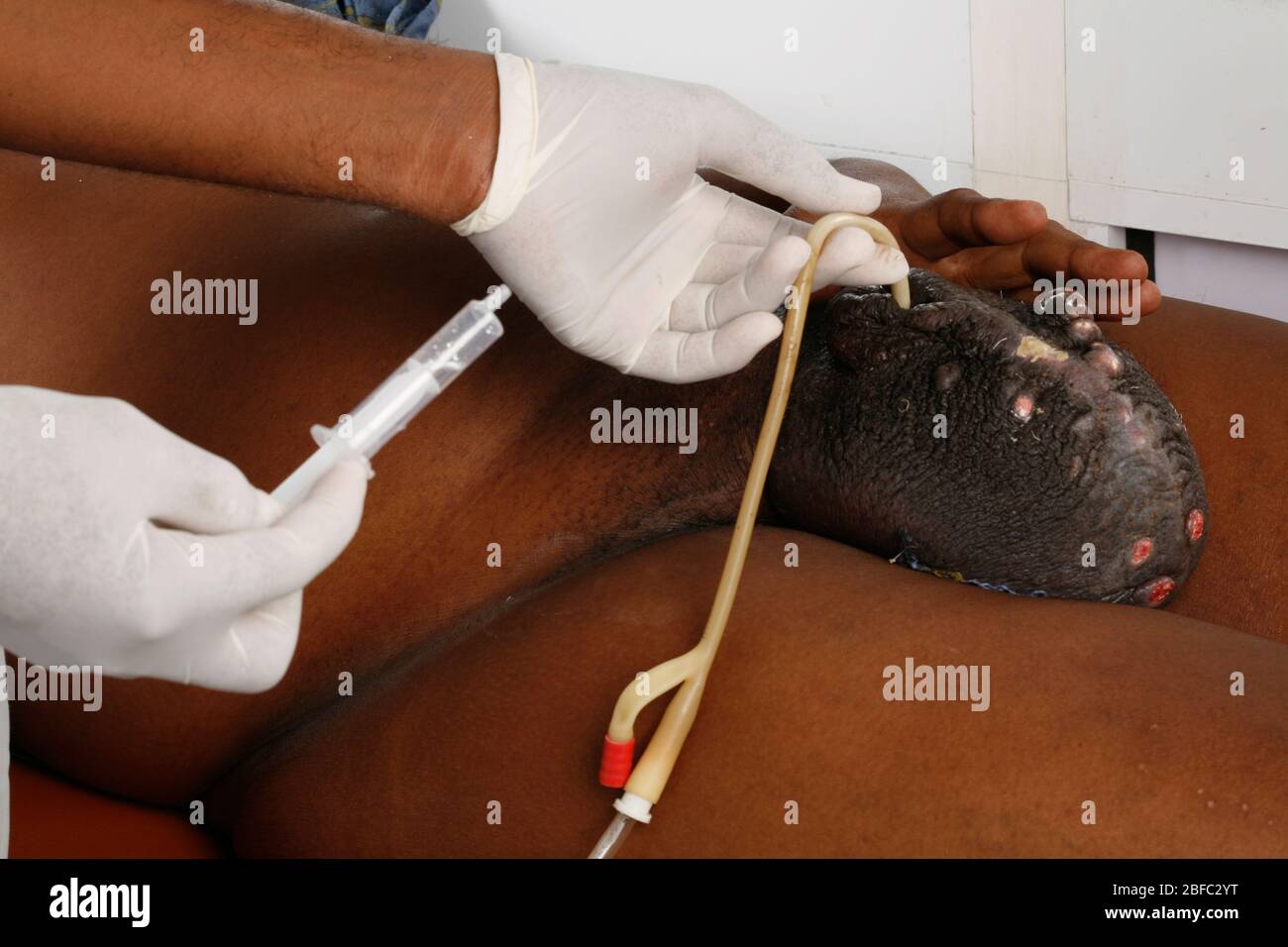 sylk gleitgel inhaltsstoffe 🗜️ Penis Hodenklemme Hodensack Fixierung Bondage Männlich Ring  Keuschheitsgerät cuckold Gürtel Schwanz Penis Ring Hoden Zurückhaltung  Schwanz Klammer Ring Bälle Halter cptc-73 3d print cnc・ STL Datei für ・Cults main image 1
