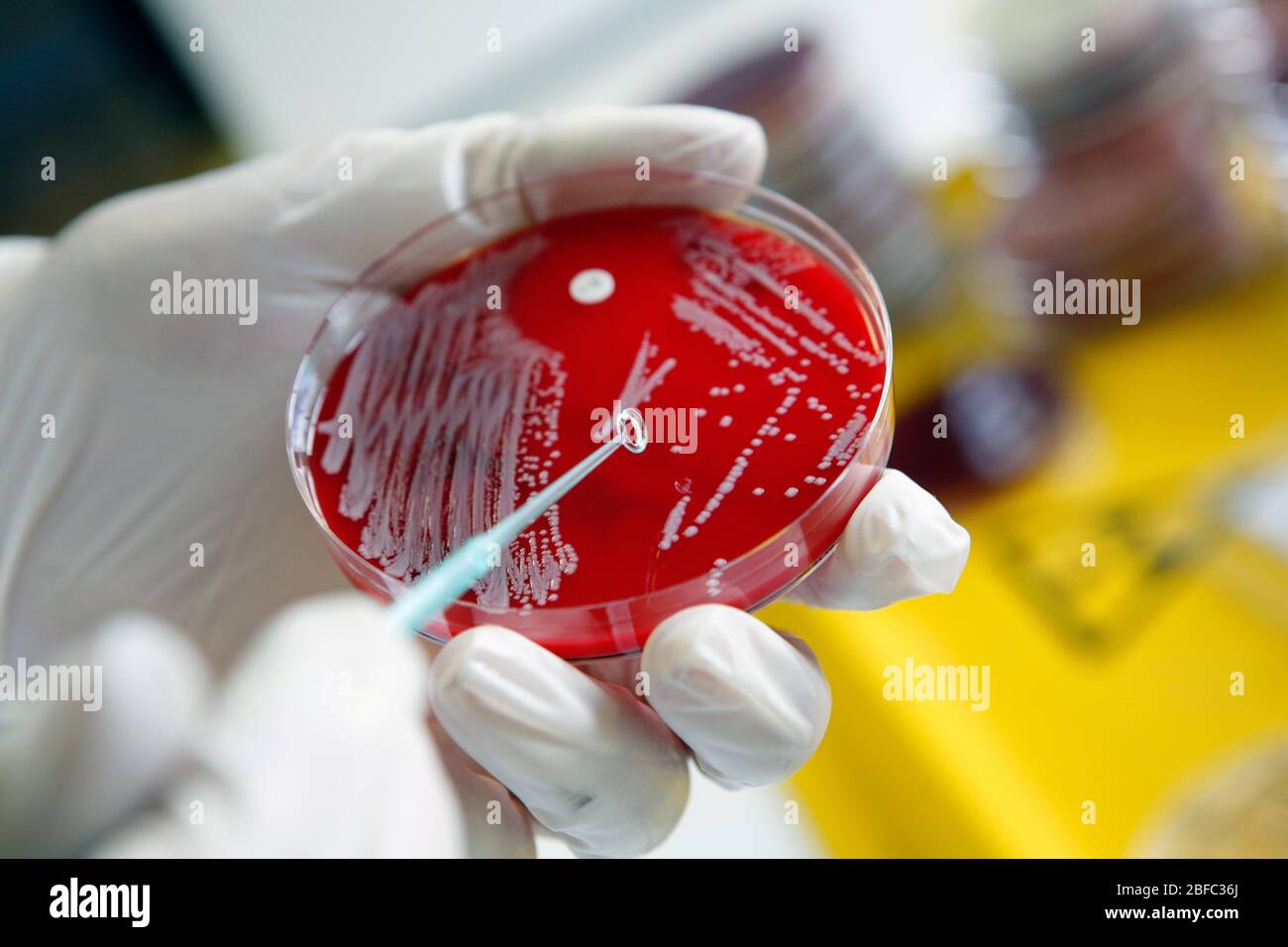 Ein Pathologe analysiert Bakterienkulturen in einer petrischarge. Stockfoto