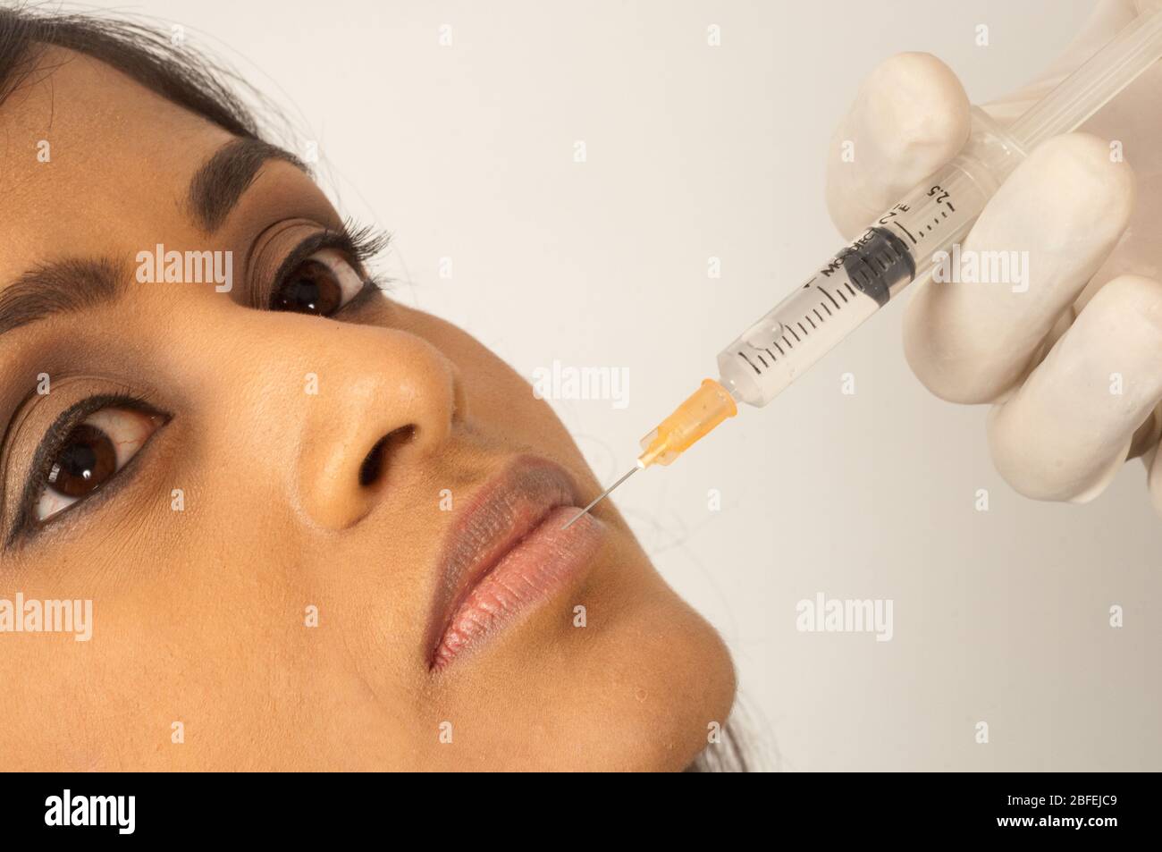 Arzt injiziert Kollagen in die Lippe einer jungen Frau (Medicimage) (Model Released) Stockfoto