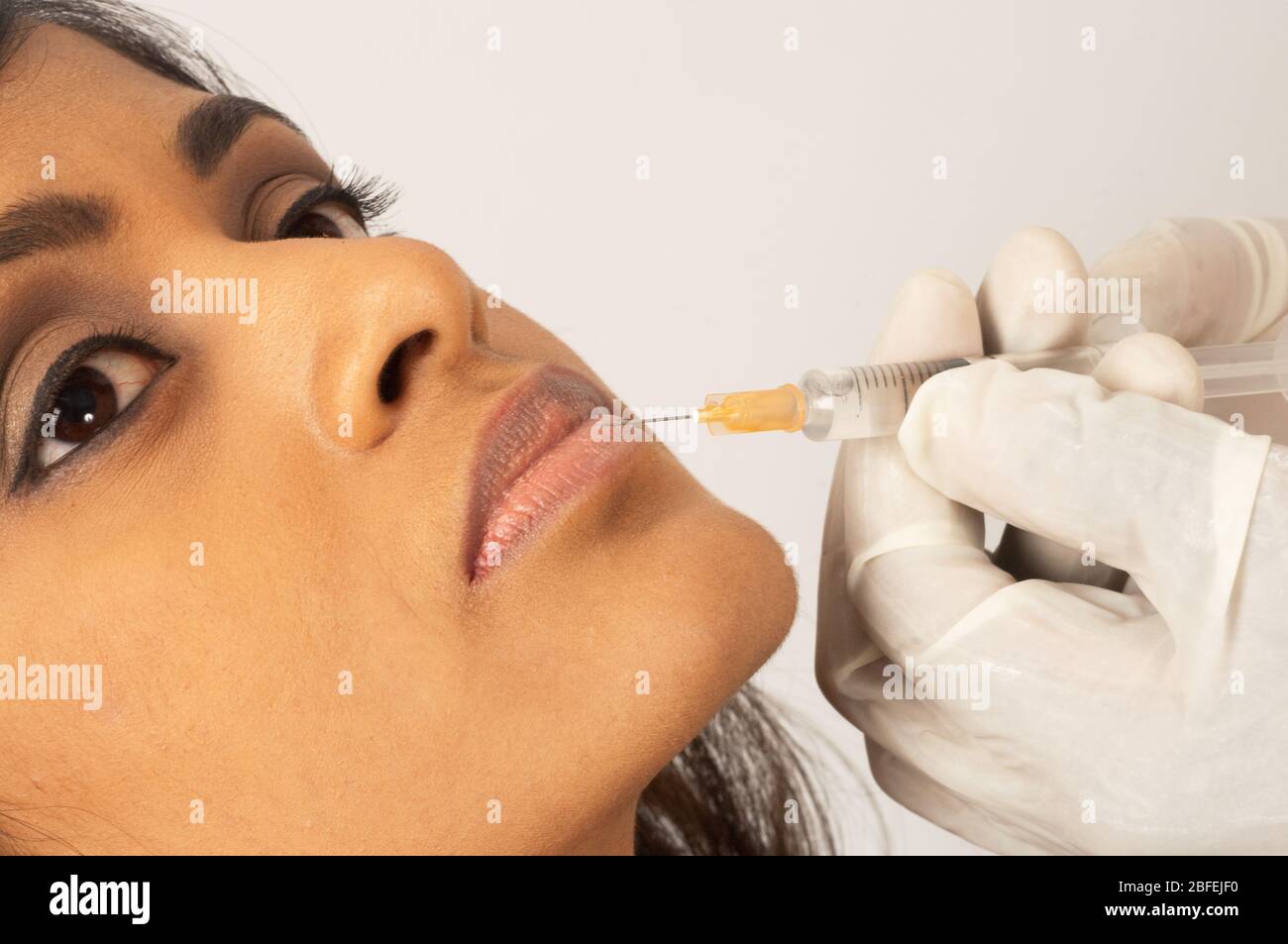 Arzt injiziert Kollagen in die Lippe einer jungen Frau (Medicimage) (Model Released) Stockfoto