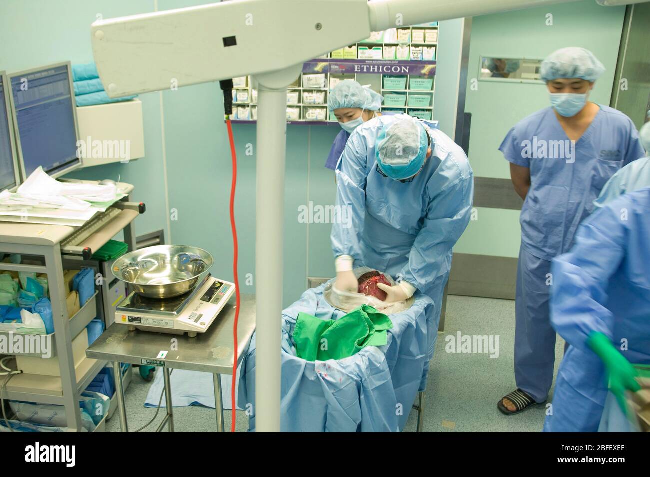Eine Spenderleber ist ungepackt und bereit für Transplantation. Samsung Medical Center, Seoul, Südkorea. Stockfoto