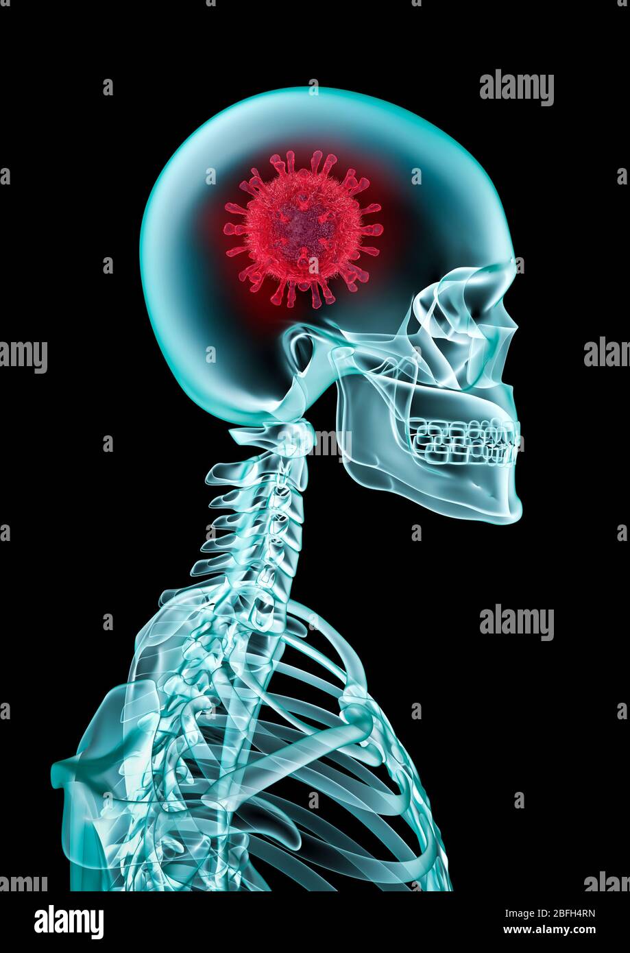 Covid-19 Röntgenkonzept / 3D-Illustration der Coronavirus-Zelle im Kopf des menschlichen Skeletts medizinischen Röntgen Stockfoto