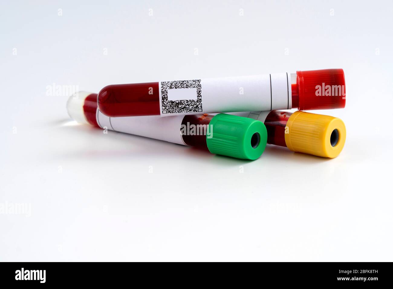 Test auf Coronavirus. Medizinischer Kolben mit Bluttest für den Virus COVID-19. Isoliert auf weißem Hintergrund. Stockfoto