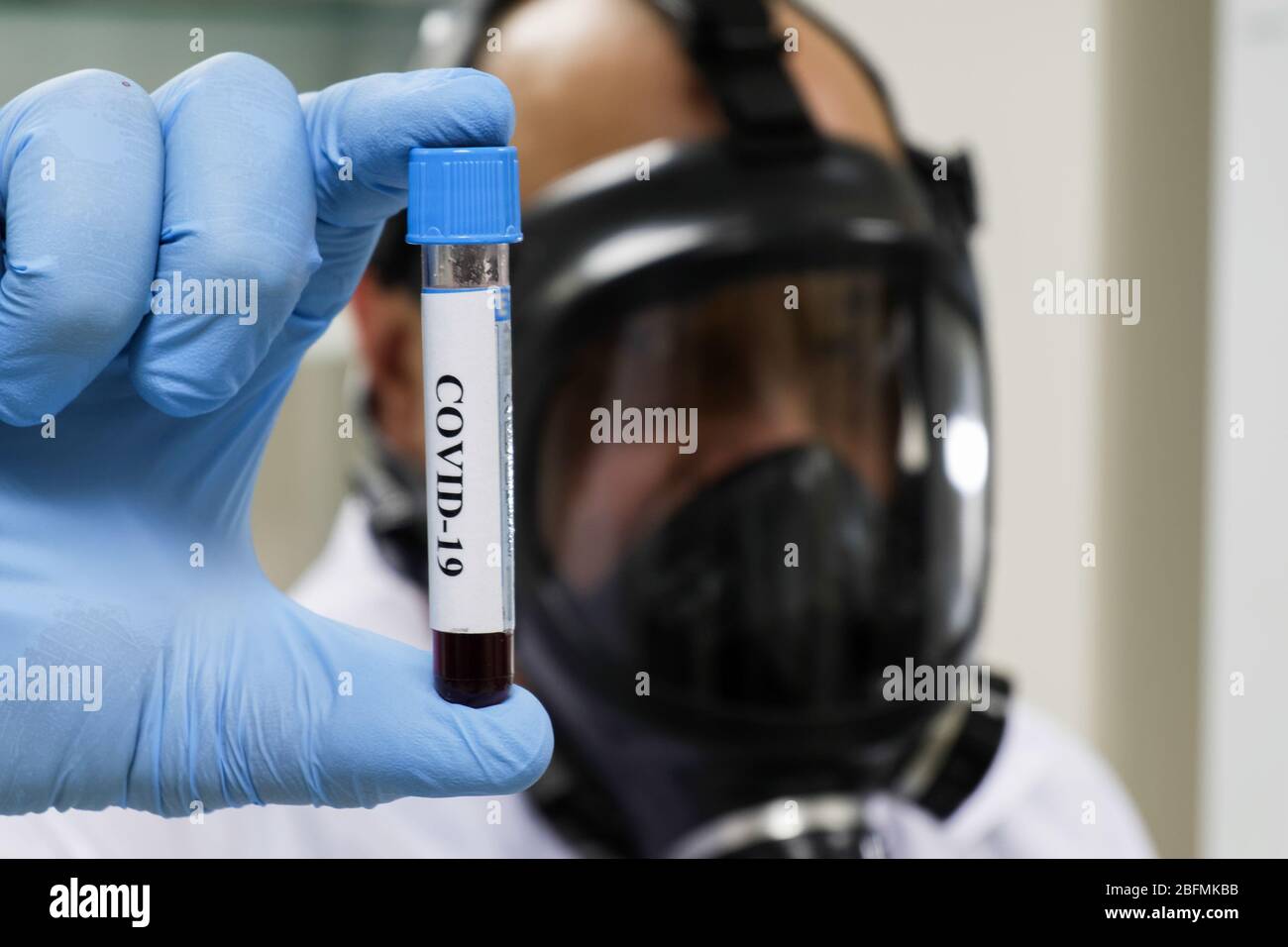 Nachweis des Coronavirus, des Erregers der Krankheit COVID-19. Blutprobe für SARS-CoV-2. Stockfoto