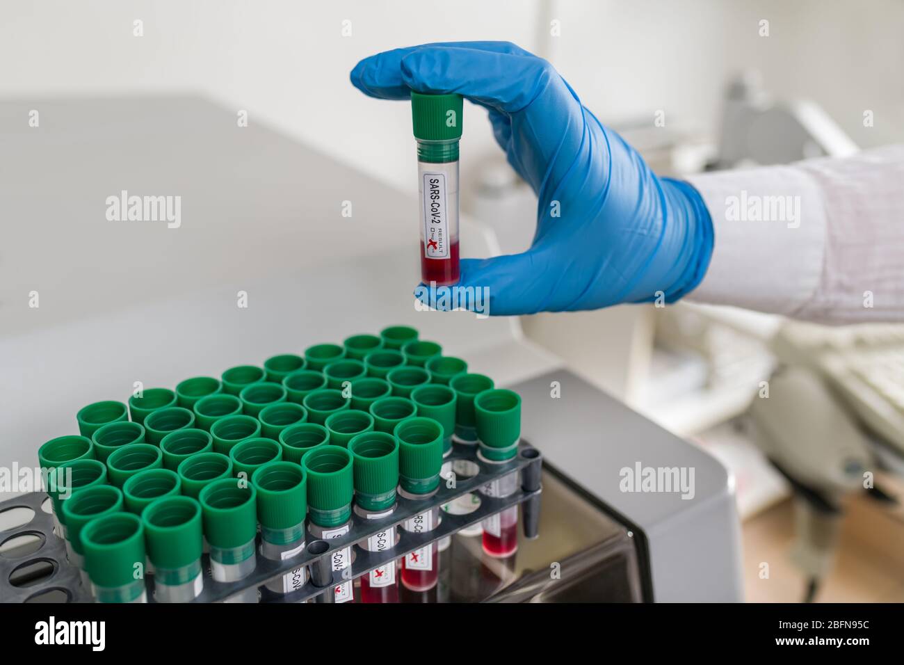 Hand in blauen Schutzhandschuh mit SARS-CoV-2-Reagenzglas. Infektiöse COVID-19-Pandemie. Labor mit automatischem Analysator und Blutproben im Rack. Stockfoto