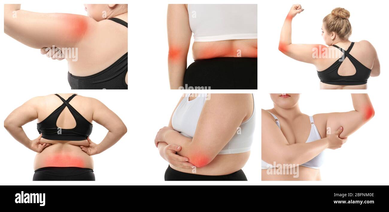 Collage mit übergewichtiger Frau, die an Schmerzen in verschiedenen Körperteilen leidet, auf weißem Hintergrund Stockfoto