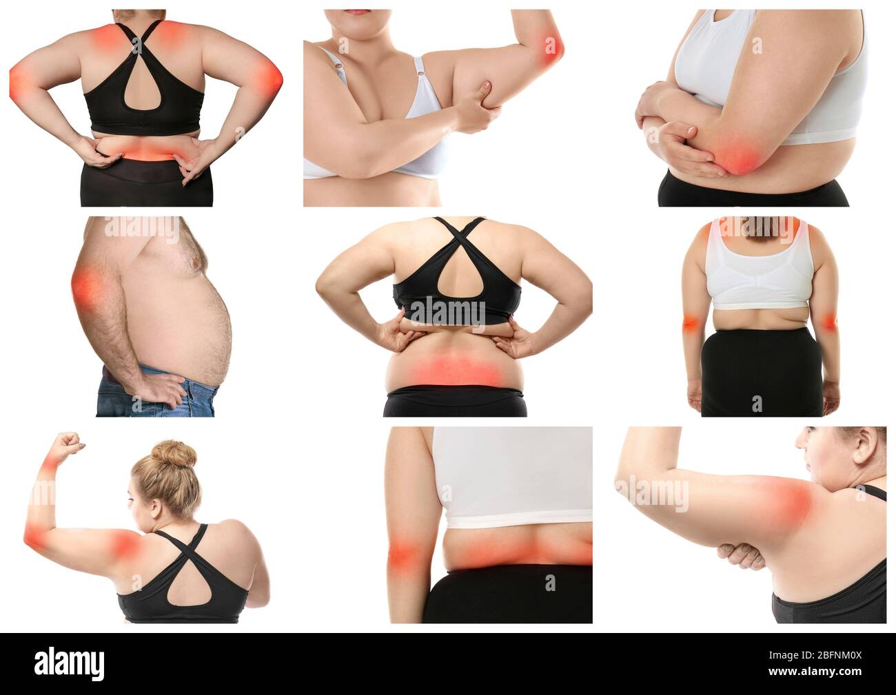 Collage mit übergewichtigen Menschen, die an Schmerzen in verschiedenen Körperteilen auf weißem Hintergrund leiden Stockfoto