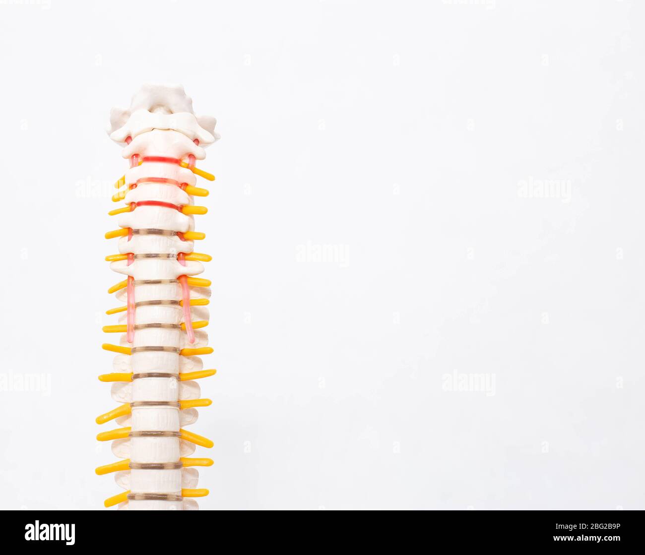 Hals- und Brustwirbelsäule auf weißem Hintergrund. Bandscheibenhernie der Halswirbelsäule, Bruch des Faserrings. Osteochondrose Stockfoto