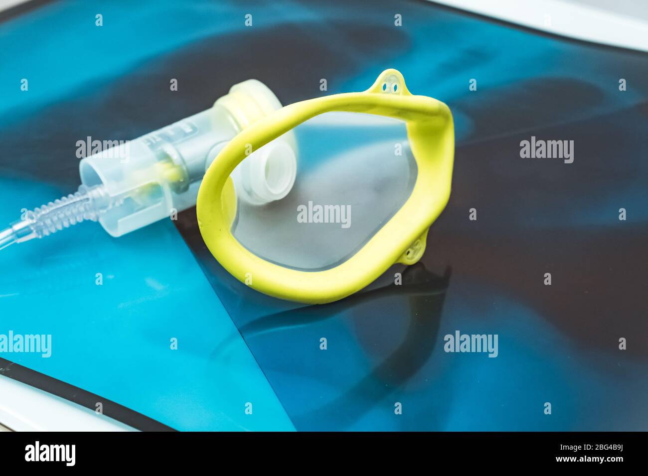 Sauerstoffmaske über den Röntgenfilmen der Brust. Covid-19 Ausbruch und Lungenentzündung. Stockfoto