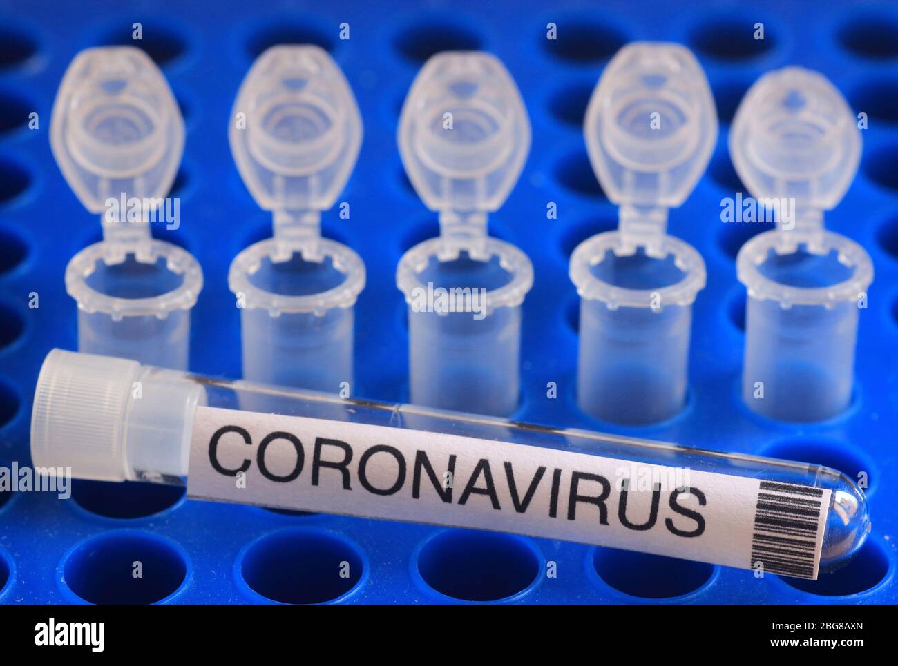 Testprotokoll mit CRISPR-Technologie zum Nachweis des Covid-19 SARS-Cov-2 neuartigen Coronavirus Stockfoto