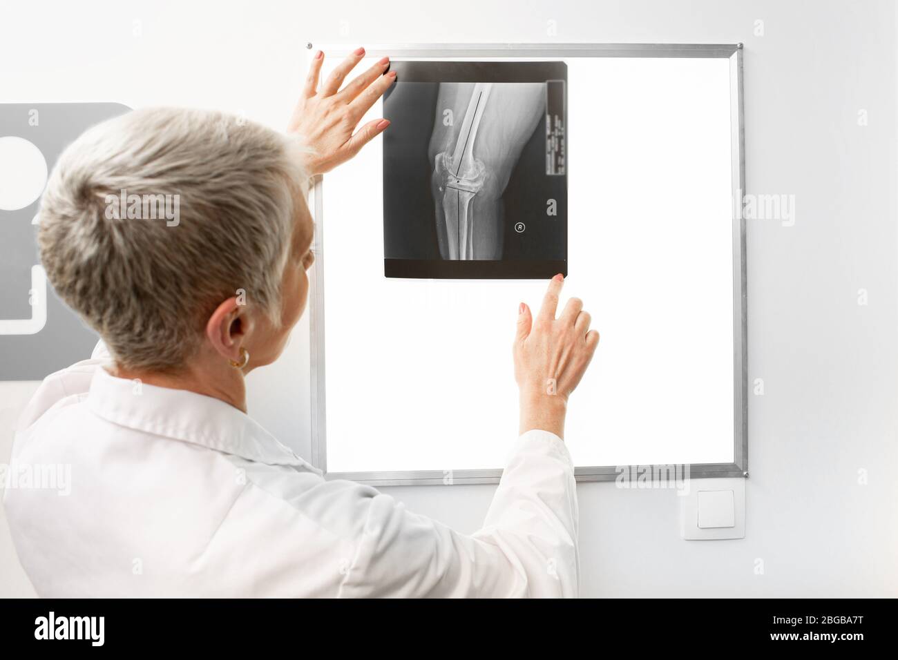Reife Arzt beobachten ein Knie Röntgenbild auf einem Negatoskop. Radiologie Stockfoto