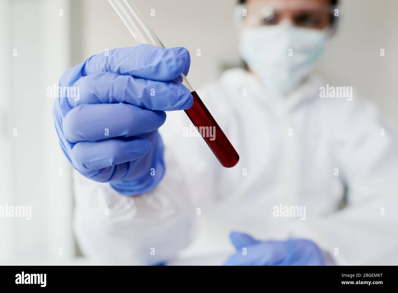 Techniker hält einen Schlauch voller Blut Stockfoto