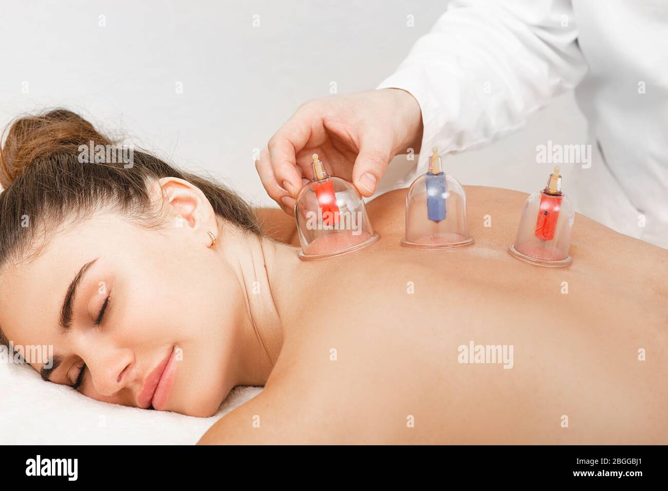 Traditionelle chinesische Medizin Arzt Massage mit Vakuumbechern zu einer weiblichen Patientin. Akupunkturbecher Nahaufnahme Stockfoto