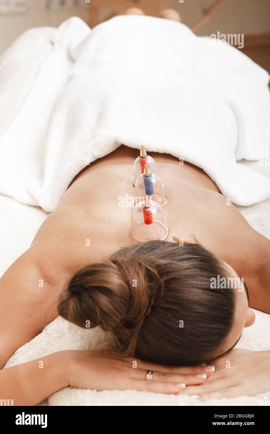 Traditionelle chinesische Medizin. Frau Erholung Gesundheit mit Vakuumbechern. Akupunkturbecher auf dem Rücken einer Frau Stockfoto