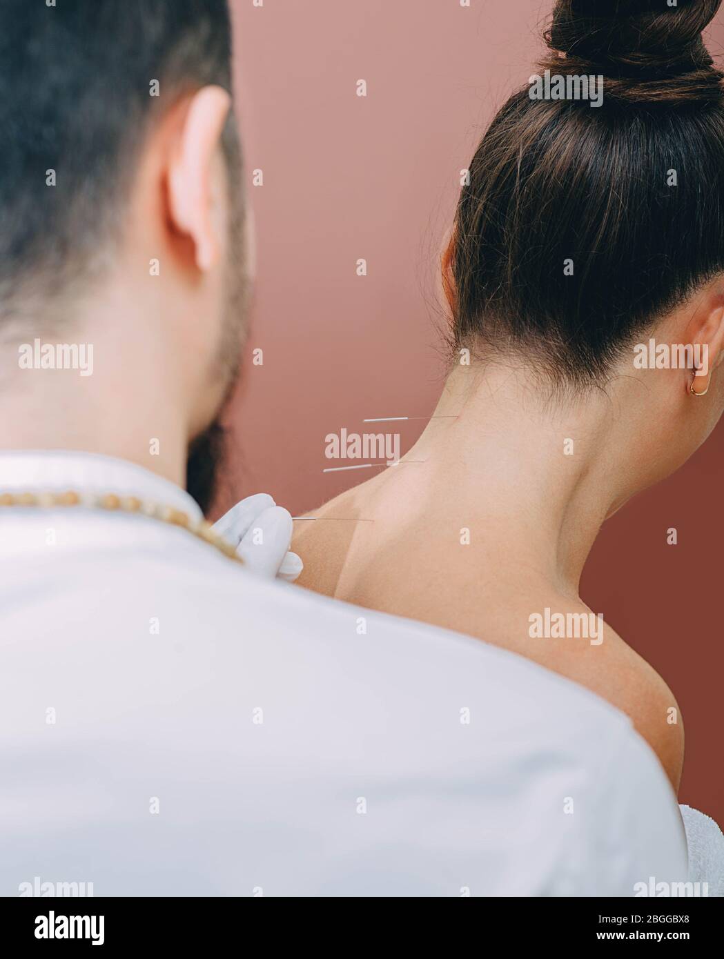 Akupunkturist punktiert Nadel an speziellen Punkten auf der Rückseite und ist sehr genau. Akupunkturnadeln aus nächster Nähe. Traditionelle chinesische Medizin Stockfoto