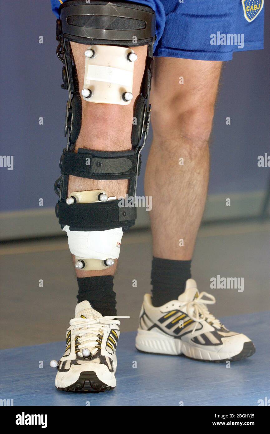 Ein männlicher Patient, der mit einer Donjoy-Kniestütze mit reflektierenden Markern geht, um den Tragekomfort zu messen. Stockfoto